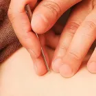 刺さない鍼