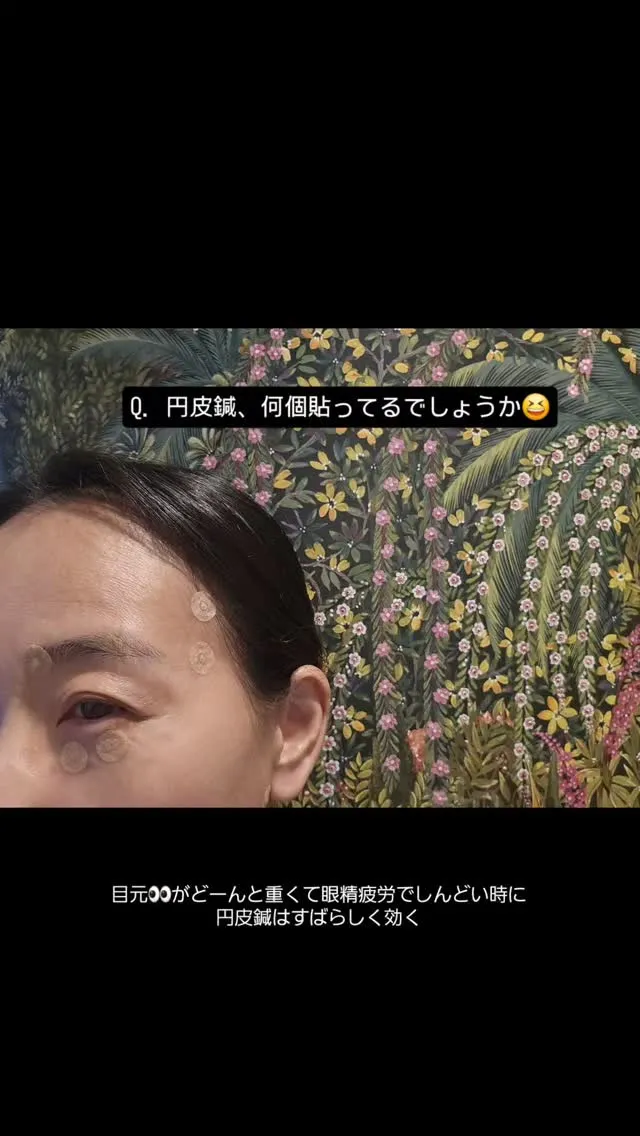 【眼精疲労に効く円皮鍼】